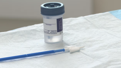 앨버타주, 자궁경부암 검사 방식 대전환... '세포 검사' 대신 'HPV 검사' 도입