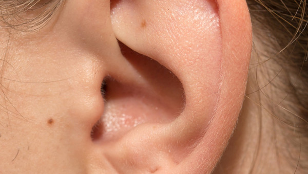 귓불에 주름 있다면?…“뇌혈관 손상 신호일 수 있어”